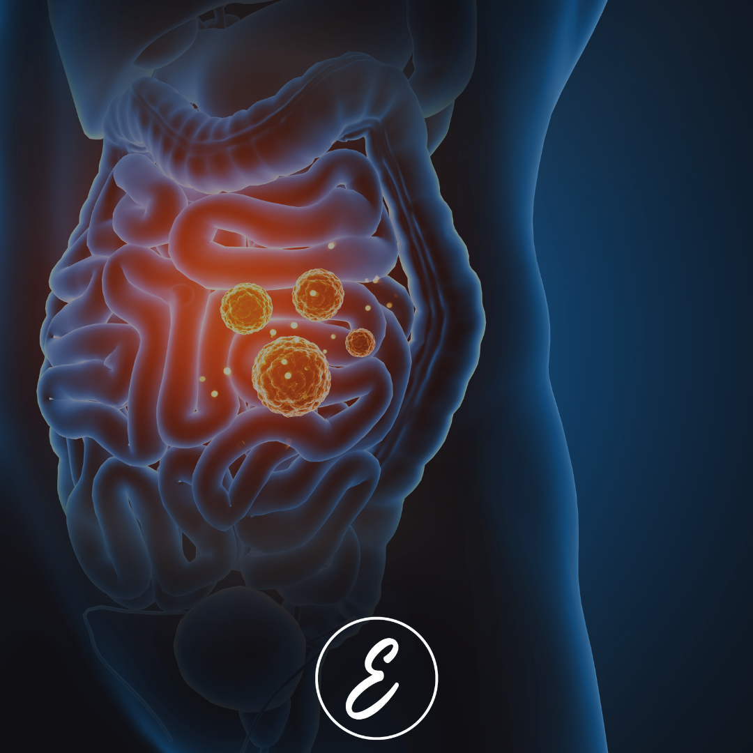 How Chronic Stress Affects Your Gut and What You Can Do About It